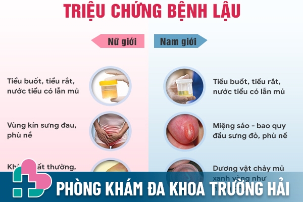 Triệu chứng điển hình của bệnh lậu ở cả nam và nữ giới