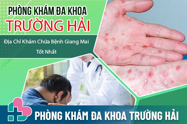 Địa chỉ chữa bệnh giang mai an toàn hiệu quả tại Thái Bình