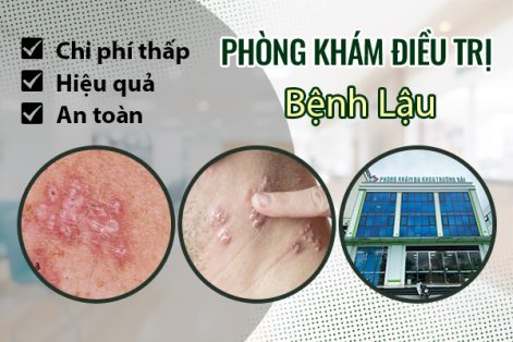 Địa chỉ chữa bệnh lậu uy tín và an toàn ở Bắc Giang