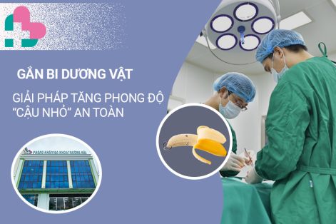 Địa chỉ gắn bi dương vật tại Bắc Ninh uy tín, an toàn