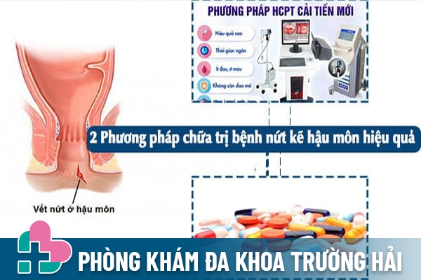 Điều trị hiệu quả chứng nứt kẽ hậu môn