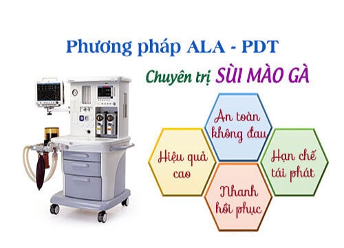 Chữa sùi mào gà bằng phương pháp ALA – PDT