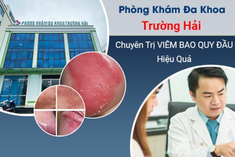 Địa chỉ chữa viêm bao quy đầu uy tín tại Tp. Chí Linh