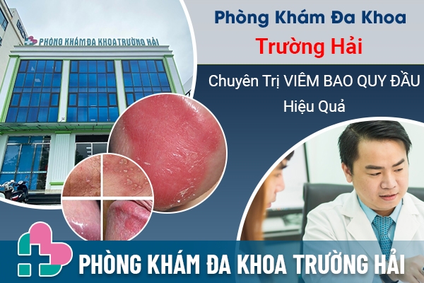 Địa chỉ chữa viêm bao quy đầu uy tín tại Hưng Yên - Phòng Khám Đa Khoa Trường Hải