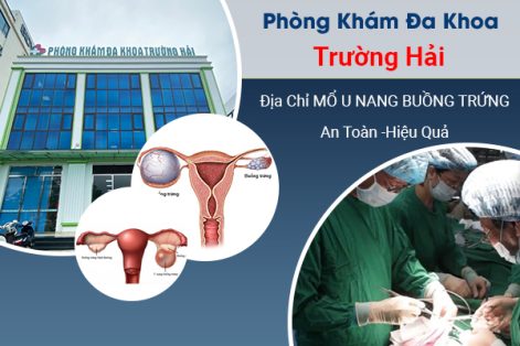 Mổ u nang buồng trứng ở đâu tốt nhất Bắc Ninh