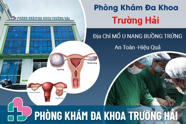 Mỗ u nang buồng trứng ở đâu tốt nhất Hưng Yên - Phòng Khám Đa Khoa Trường Hải