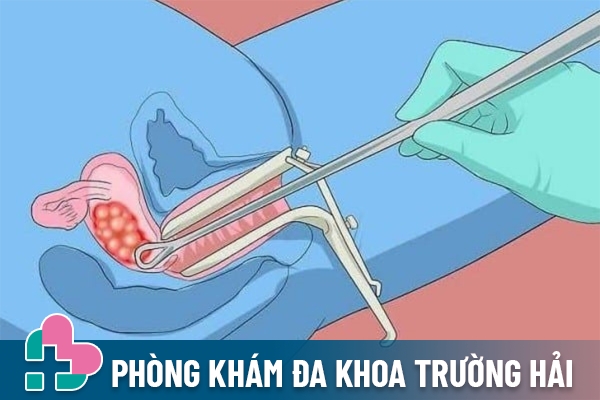 Biện pháp điều trị thai trứng