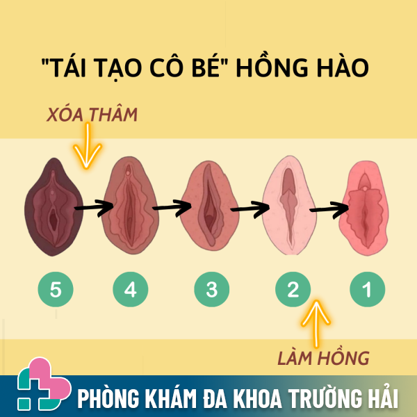 Thế nào mới được gọi là môi bé đẹp