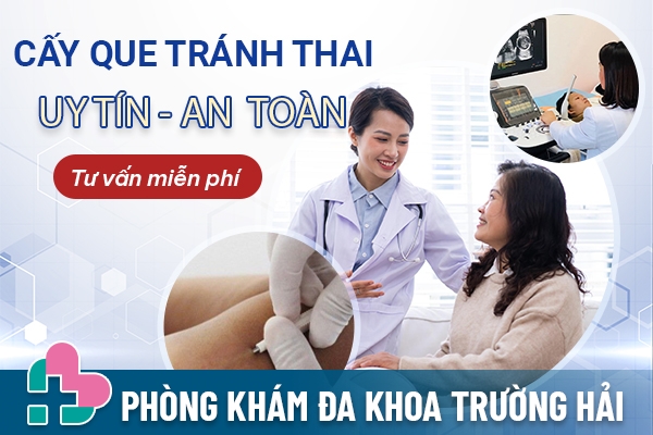 Địa chỉ cấy que tránh thai uy tín ở Hưng Yên