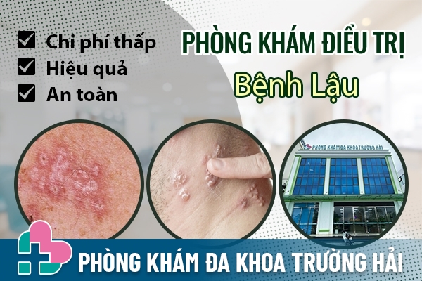 Địa chỉ chữa bệnh lậu uy tín và an toàn ở Huyện Tứ Kỳ