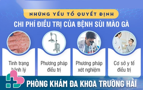 Những yếu tố quyết định đến chi phí sùi mào gà ở Hải Dương