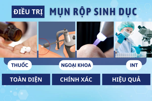 Phương pháp điều trị hiệu quả bệnh mụn rộp sinh dục