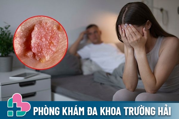 Từng bị sùi mào gà có sinh thường được không?