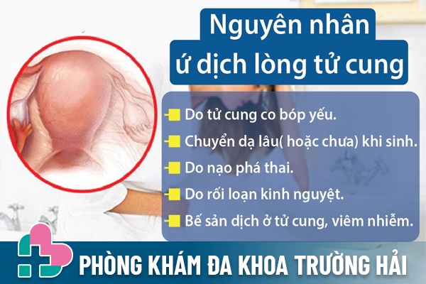 Nguyên nhân ứ dịch lòng tử cung 