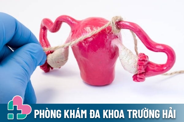 Chi phí thắt ống dẫn trứng hết bao nhiêu tiền tại Hải Dương