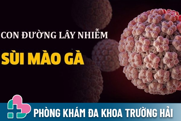 Con đường lây nhiễm sùi mào gà?