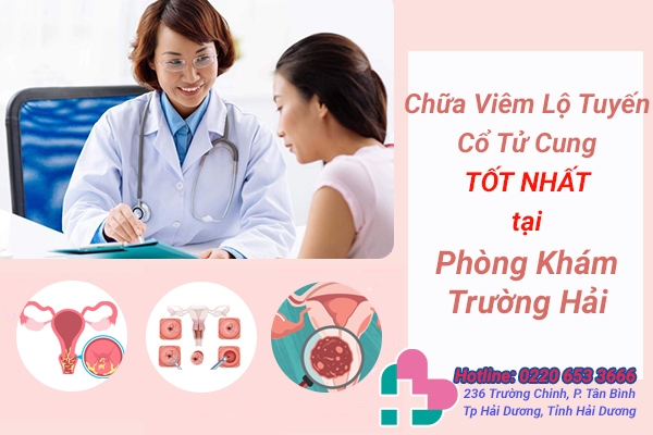 Địa chỉ chữa viêm lộ tuyến cổ tử cung tốt nhất Hải Phòng