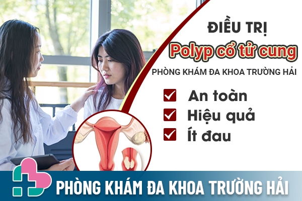 Địa chỉ điều trị polyp cổ tử cung an toàn tại Thái Bình