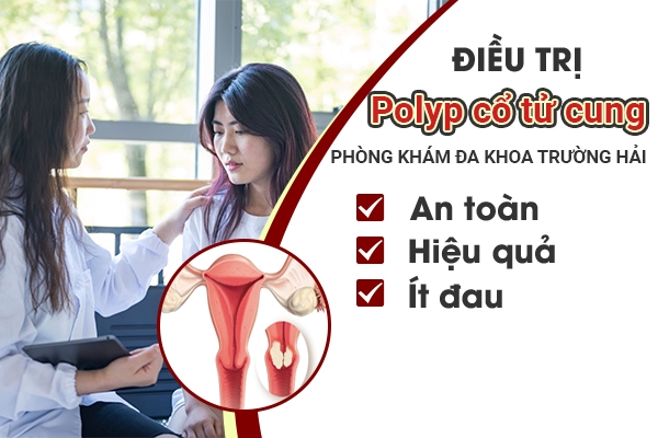 Địa chỉ điều trị polyp cổ tử cung an toàn tại Thành Phố Chí Linh