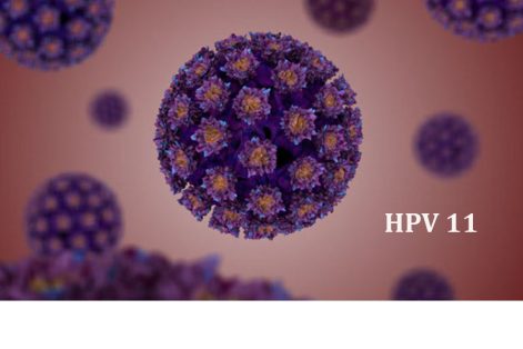 HPV type 11 là gì? Có gây bệnh nguy hiểm không?