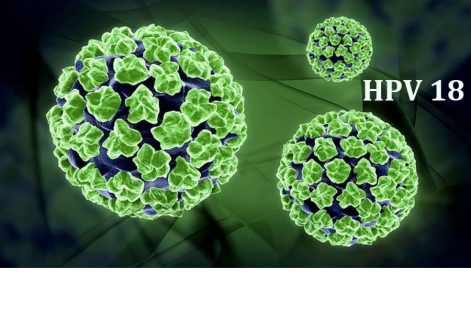 HPV type 18 là gì? Có nguy hiểm không? Làm gì khi bị nhiễm?