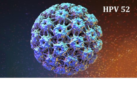 HPV type 52 là gì? Có nguy hiểm không? Cách ngăn ngừa