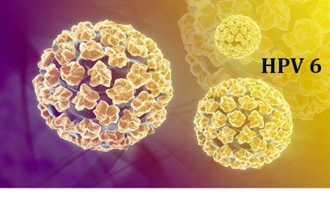 HPV type 6 là gì? Có nguy hiểm không? Cách điều trị hiệu quả