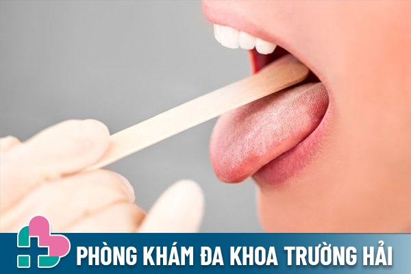 Phương pháp xét nghiệm sùi mào gà ở miệng, họng, chân răng, môi, cuống lưỡi