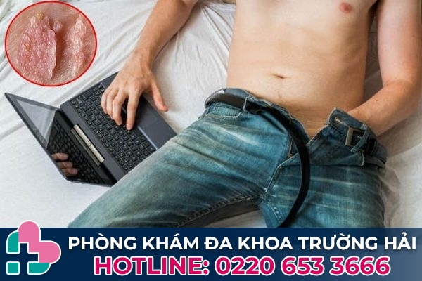 Quay tay có bị sùi mào gà không?