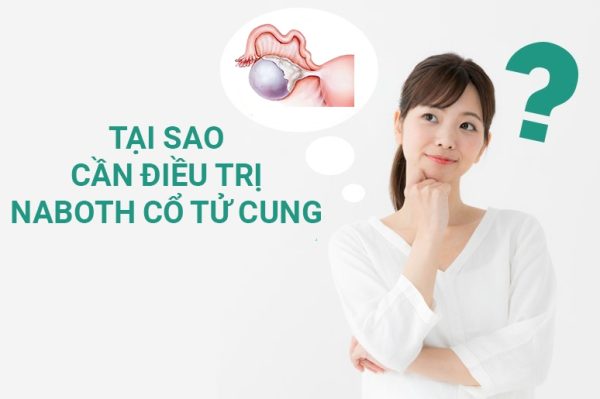 Tại sao cần điều trị nang naboth cổ tử cung?