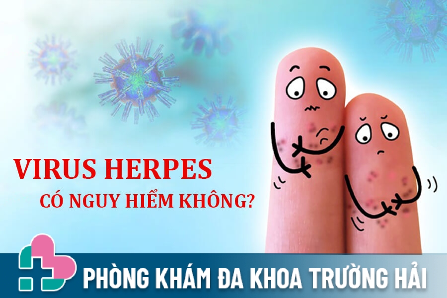 Virus Herpes: Triệu chứng, nguyên nhân, cách phòng ngừa và điều trị