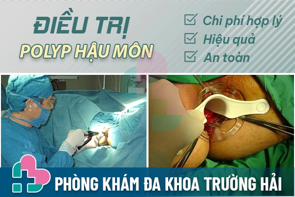 Địa chỉ khám và điều trị polyp hậu môn ở Bắc Ninh