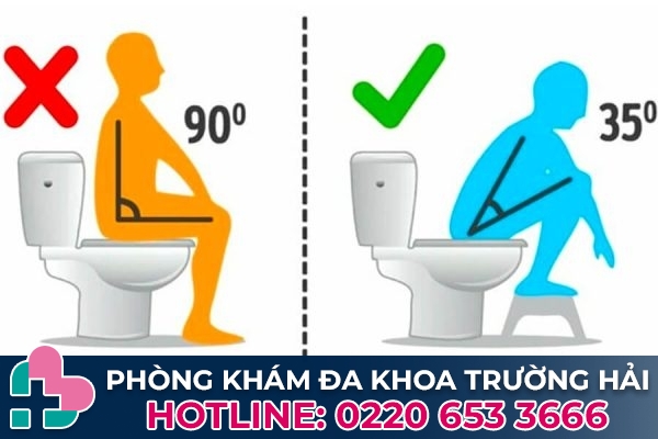 Tư thế ngồi tốt cho người bệnh trĩ khi đại tiện