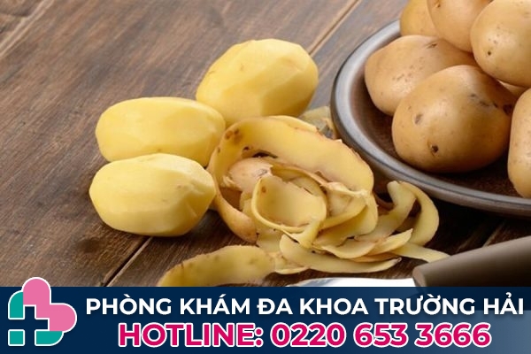 Cách chữa bệnh trĩ bằng khoai tây