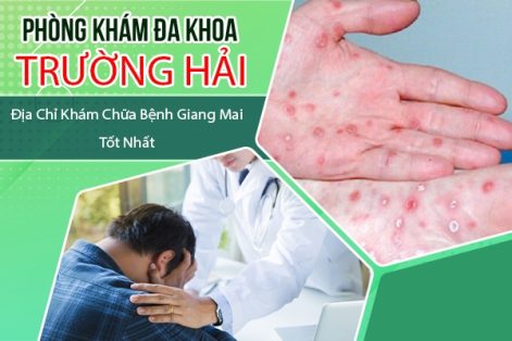 Địa chỉ xét nghiệm giang mai tại Huyện Ân Thi uy tín