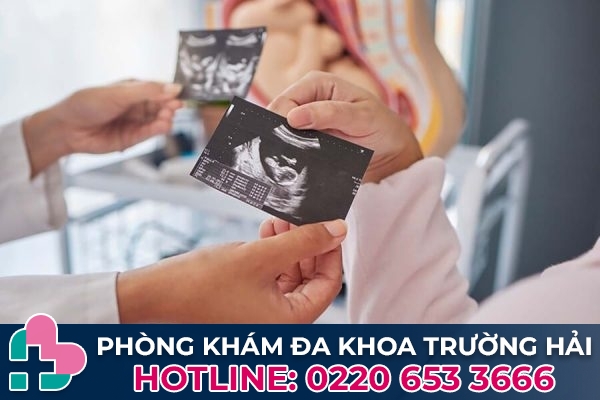 Cần theo dõi dấu hiệu phá thai bằng thuốc thành công và không thành công để kịp thời xử lý biến chứng