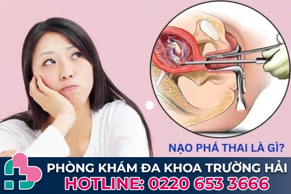 Nạo phá thai là gì?