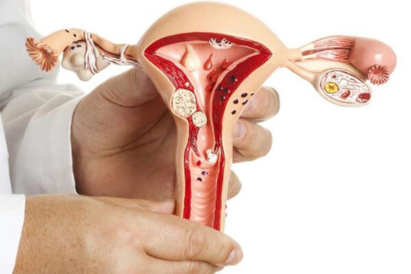 Phá thai 2 lần liên tiếp gây ảnh hưởng đến tử cung