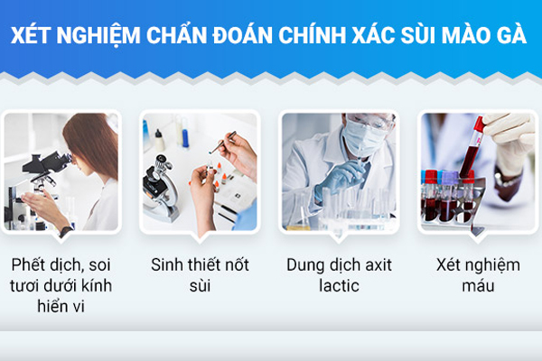 Cách chẩn đoán sùi mào gà ở lưỡi