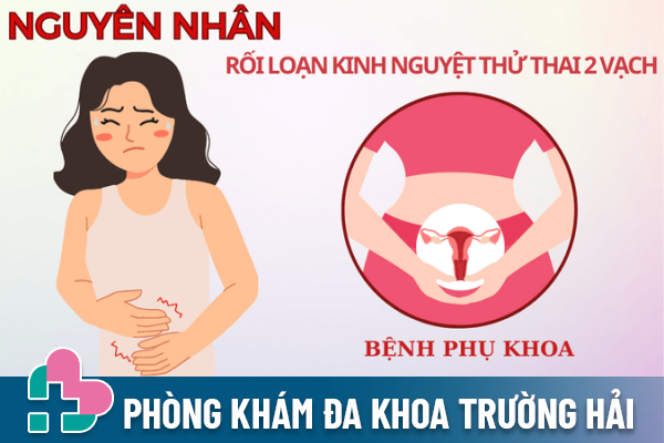 Nguyên nhân bị rối loạn kinh nguyệt thử thai 2 vạch - Do bệnh phụ khoa