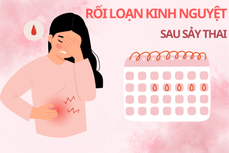 Rối loạn kinh nguyệt sau sảy thai: Những Điều Cần Lưu ý