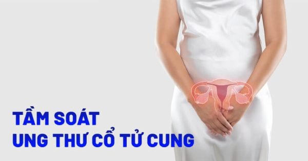 Định nghĩa tầm soát ung thư cổ tử cung